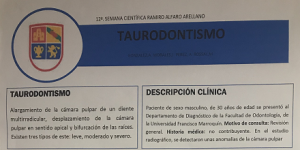 taurodontismo thumb